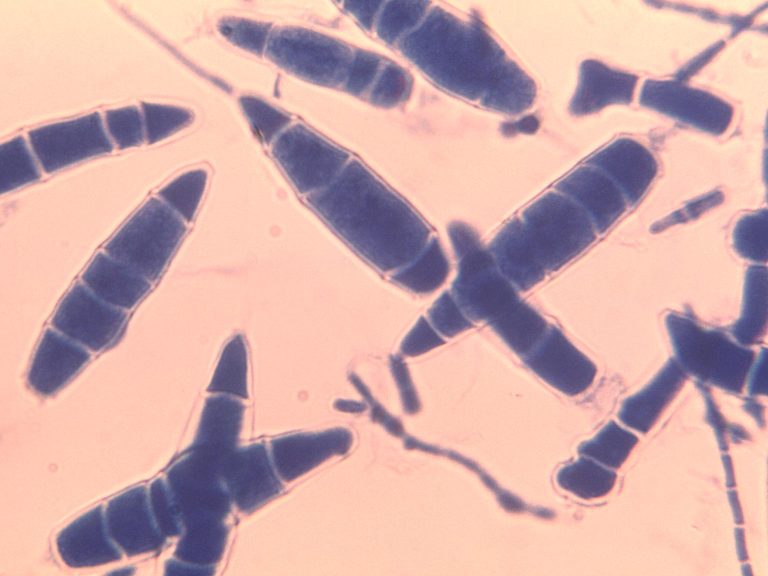 Microsporum Canis