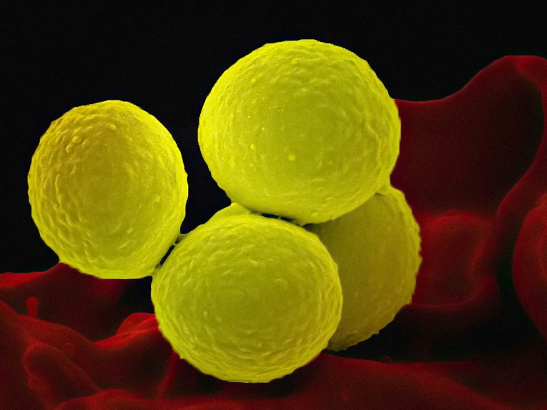 staphylococcus aureus