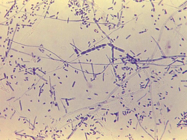 Trichophyton Rubrum