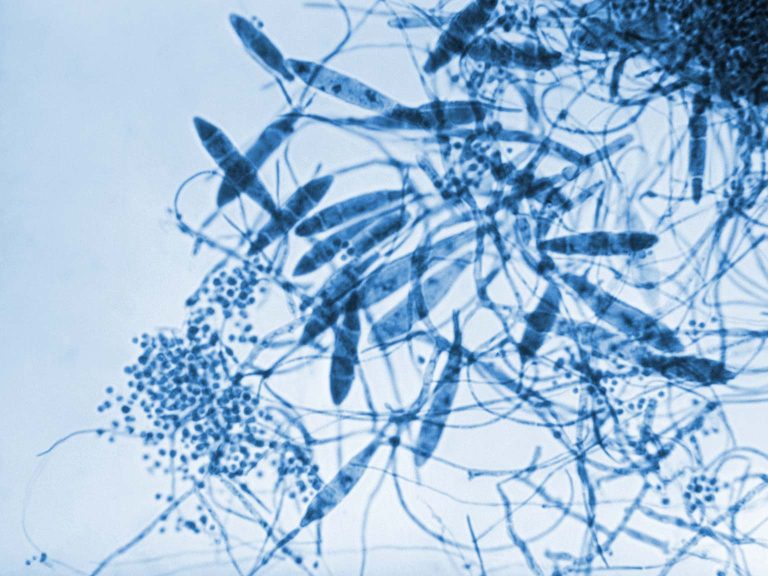 Trichophyton mentagrophytes