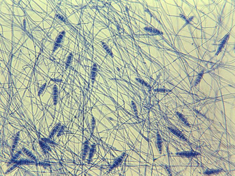Microsporum Canis